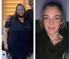 Absolutly do it 🥰