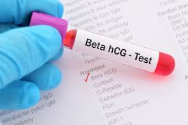 The air force pt test is what a lot of people are curious about before joining the air force or any other branch of the military. Testul Beta Hcg Si Diagnosticul De Sarcina Dr Alina Bolintineanu