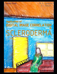 Application of Digital Image Correlation in SCLERODERMA: 9781694826336:  Medicine & Health Science Books @ Amazon.com