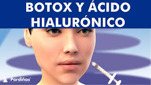 Violación se produce cuando se prepara para el procedimiento, técnicas. Acido Hialuronico En La Cara O Botox Tratamiento Antiarrugas Y Lineas De Expresion C Youtube