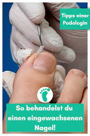 eingewachsenen zehennagel behandeln fusspflegeblog eingewachsener nagel eingewachsener zehennagel zehennagel