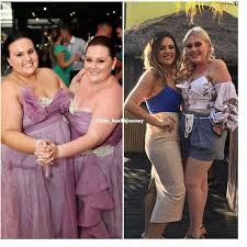 Pin On Vorher Nachher