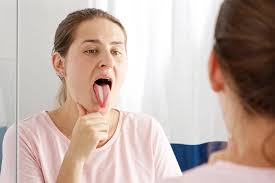 Image result for brown tongue symptoms