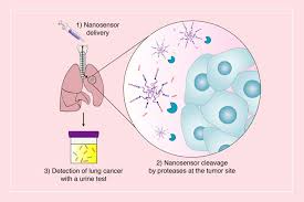 The most common symptoms of lung cancer are: New Sensors Could Offer Early Detection Of Lung Tumors Mit News Massachusetts Institute Of Technology