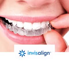 Image result for dental braces