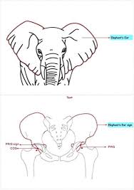 Utilizes the diagrammer and visnetwork libraries. Schematic Diagram Of Elephant S Ear Appearance And A Depiction Of Download Scientific Diagram