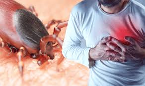 Lyme Disease Symptoms Of A Bite Can Be More Severe Than A Rash If Treatment Is Not Taken Express Co Uk