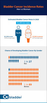 How is bladder cancer diagnosed and assessed? What To Know About Bladder Cancer In Women Cxbladder