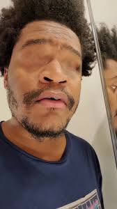 No Eyes Filters: Exploring the Trending TikTok Effects