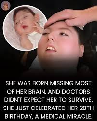 Against all medical odds, she's still here. Alex Simpson just celebrated  her 20th birthday, omething doctors said would never happen 💙 When Alex  was born in Nebraska in 2005, doctors discovered she