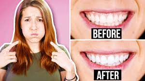 The process involves swishing oil around your mouth, and the oil will mix with your saliva, absorbing and pulling toxins from your mouth. We Tried A Weird Ancient And Viral Beauty Hack To Whiten Teeth Oil Pulling Youtube