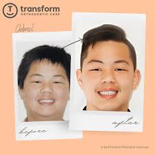 Transform Orthodontic Care