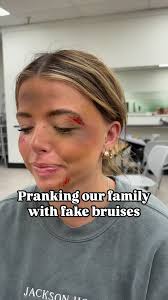 We know this is a horrible joke and will never do it again but it was funny  for one time 😂 , #fakebruises #bruise #makeup #makeupartist #cosmetology  #funny #funnyvideo #fyp #viral