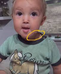 Veterinarian kids playing the "hurt" part well