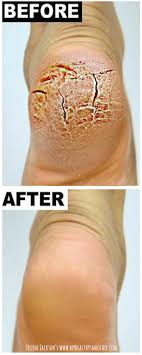 Pin On Beauty Tips And Hacks
