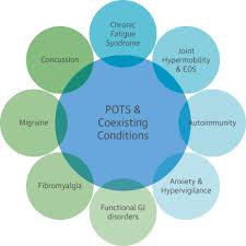 Postural Orthostatic Tachycardia Syndrome Jacc Focus Seminar Sciencedirect