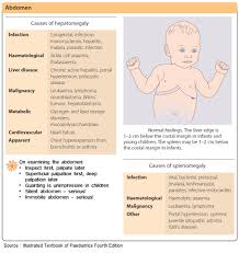 Image result for Splenomegaly