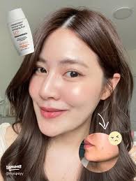 Acne is so heavy. I don't dare to use sunscreen. I'm afraid of clogging it.  Which face is it?