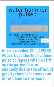 Image result for Collapsing Pulse