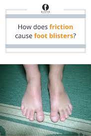 Static Friction Vs Dynamic Friction Blister Formation Blister Prevention Blisters Best Hiking Gear Foot Injury