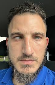 hi‚ earlier my stomach hurt and i went to the cr‚ then suddenly my eyes  went dark and i leaned against the wall. it took about 5 minutes before i  opened my