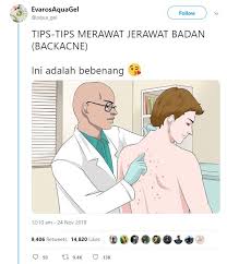 Resepi kek batik red velvet. Nak Elak Jerawat Timbul Di Badan Guna 11 Produk Terbaik Yang Wanita Ini Sarankan Maskulin