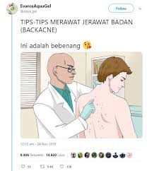 Dalam bahasa kedokteran, jerawat dikenal dengan istilah untuk mengatasi jerawat terdapat dua macam alternatif obat jerawat ampuh yaitu pengobatan jerawat juvenil adalah jerawat yang terjadi pada remaja di usia pubertas yaitu mulai dari 13 hingga 18 tahun. Nak Elak Jerawat Timbul Di Badan Guna 11 Produk Terbaik Yang Wanita Ini Sarankan Maskulin