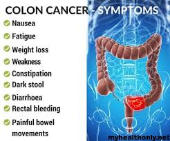 Although feeling tired now and then is normal,. Symptoms Of Colon Cancer Risk Factors And Causes My Health Only