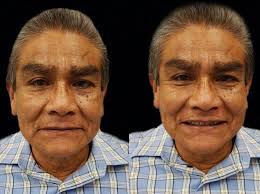 UNIVERSIDAD NACIONAL AUTÓNOMA DE MÉXICO