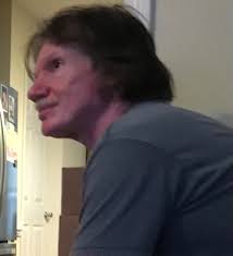 Wilbert "Mickey" Watson Obituary