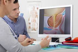 prostate cancer is the second most common cancer among men in the united states. What Is Prostate Cancer Koelis