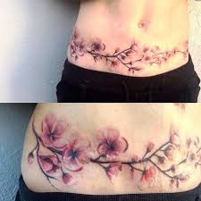 Usually, tummy tuck involves removing a large amount. Pin On Tats