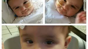 formerly-conjoined-twins-turn-1