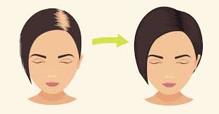 They have withstood the test of time and even in the modern time and age, people resort to it, when they are tired of using harmful chemicals on their scalp. Baking Soda Stops Hair Loss Promotes Hair Growth In No Time David Avocado Wolfe