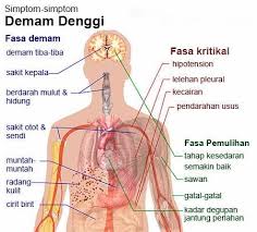 Demam bayi ini terbahagi kepada dua kategori. Info Banjir Tanda Tanda Demam Denggi Denggi Berpunca Daripada 4 Virus Yang Berkait Rapat Iaitu Den 1 Den 2 Den 3 Atau Den 4 Denggi Merebak Kepada Manusia Melalui Gigitan Nyamuk Yang Telah Dijangkiti Virus Denggi