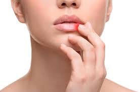 The Upside of Herpes — When One Infection Protects Against Another