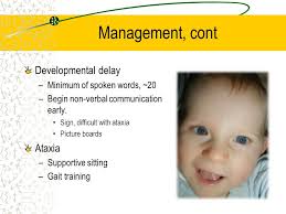 Angelman Syndrome Craig Dobson, MD CPT, MC, USAR NCC Pediatrics.