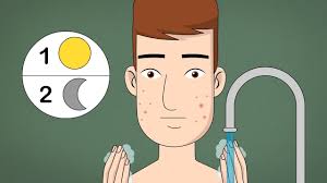 How to get clear skin. How To Treat Acne Teen Boys 11 Steps With Pictures Wikihow
