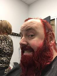 Dyeing my hair for St Baldricks