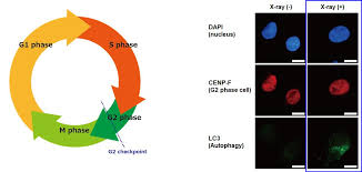 When signs and symptoms of pancreatic cancer occur, they include (these to not occur in pancreatitis): Finding The Weak Points In Radiation Resistant Pancreatic Cancer Cells