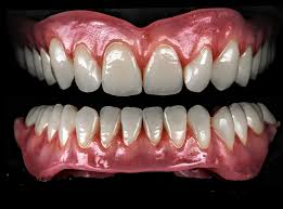Dentures are replacements for missing teeth that can be taken out and put back into your mouth. What Is The Most Natural Looking Dentures