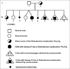 And when people with this translocation carry a child to term, the child may be at a higher risk for chromosomal imbalance. Dermatoglyphics And Reproductive Risk In A Family With Robertsonian Translocation 14q 21q Abstract Europe Pmc
