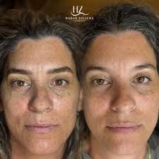 בוקר טוב 🌈 לצורך הרחבת תיק עבודות מחפשת בחורה אחת ומיוחדת;) לטיפול  מיקרובליידינג בעלות סמלית של 600₪ בלבד ‼️ * בתמונה