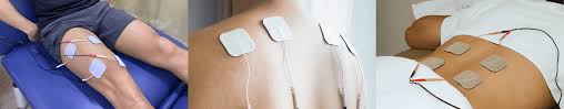 Image result for Electrical Stimulation Therapy