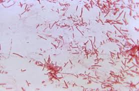 Image result for Shigella