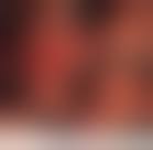 Image result for Colonoscopy in GI Bleeding