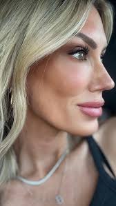 Erma, Professional Laser Specialist