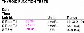 Image result for Thyroid Function Test