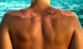 Benzene is a chemical that, when activated with exposure to the skin, blood, or organs, can affect changes in. Recent Study Shows How Sunscreen Not The Sun Causes Cancer Face Aid Total Block Sunscreen