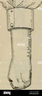 A treatise on artificial limbs with rubber hands and feet ... !?: ::;: :?:  :.;: >: .::?: !•: IG23.. fX Stock Photo - Alamy